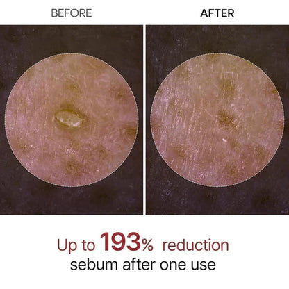 Final 3 Hours: 42% OFF🔥 Gentle Exfoliator Glow Rice Ampoule-Suitable for All Skin Types-
