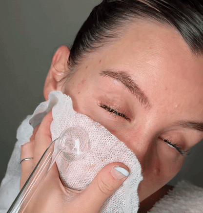 Vivand High Frequency Wand